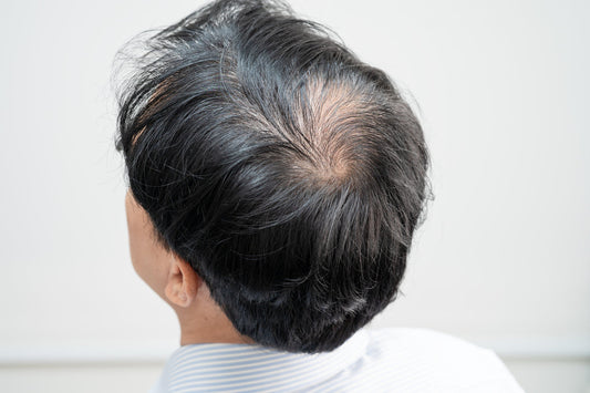 The Link Between Stress and Hair Loss: How to Protect Your Hair During Tough Times