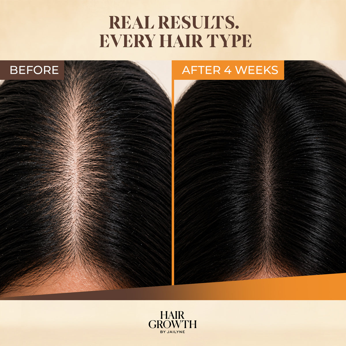 Magic Drop Hair Growth Serum - Anti-Thinning Scalp Treatment (2 oz)