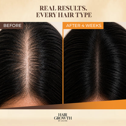 Magic Drop Hair Growth Serum - Anti-Thinning Scalp Treatment (2 oz)
